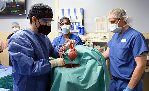 Heart Transplant Surgery2